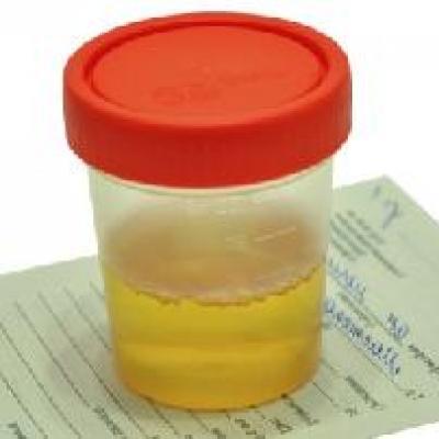 « Mauvaises habitudes » (Analyse des urines pour la nicotine, les substances psychotropes et narcotiques, les drogues psychoactives) Restrictions sur le test